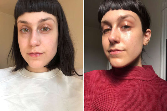 skin vitamin c serum before and after